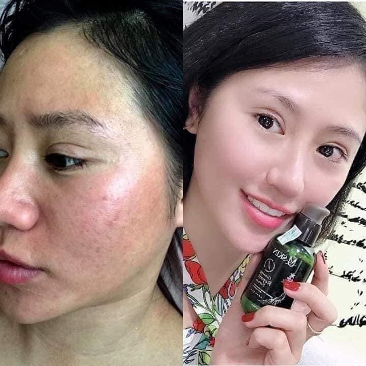 Tái tạo da nhân sâm MQ Skin